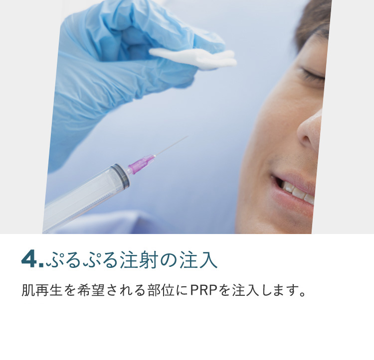 2.ぷるぷる注射作製用の採血