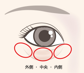 眼窩脂肪は、内側・中央・外側の3つのパートに分かれています。