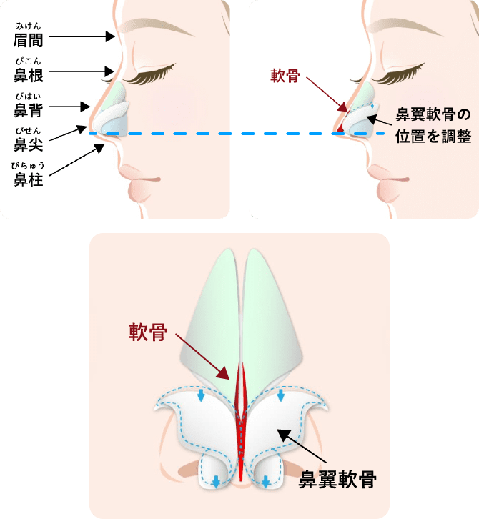 鼻尖（鼻先）を下げる方法