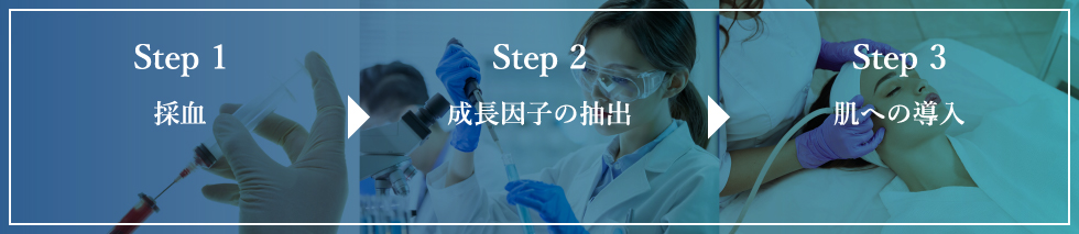 Step1 採血 Step2 成長因子の抽出 Step3 肌への導入