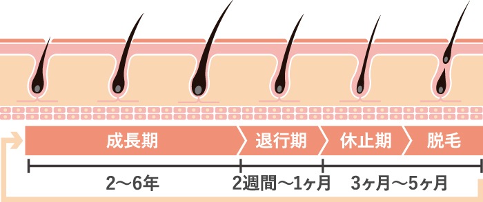 正常な毛髪の寿命はどのくらい？