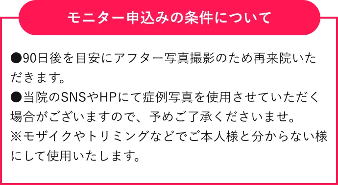 モニター申込みの場合の条件について