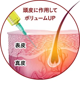 頭皮に作用してボリュームUP 表皮 真皮