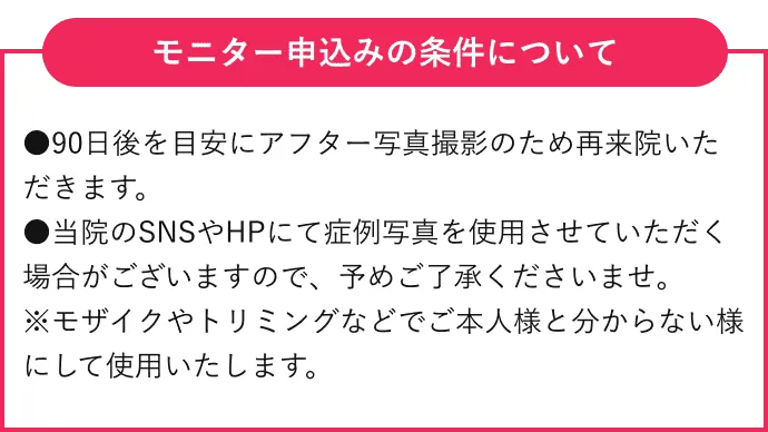 モニター申込みの場合の条件について