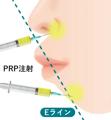 口ゴボの状態