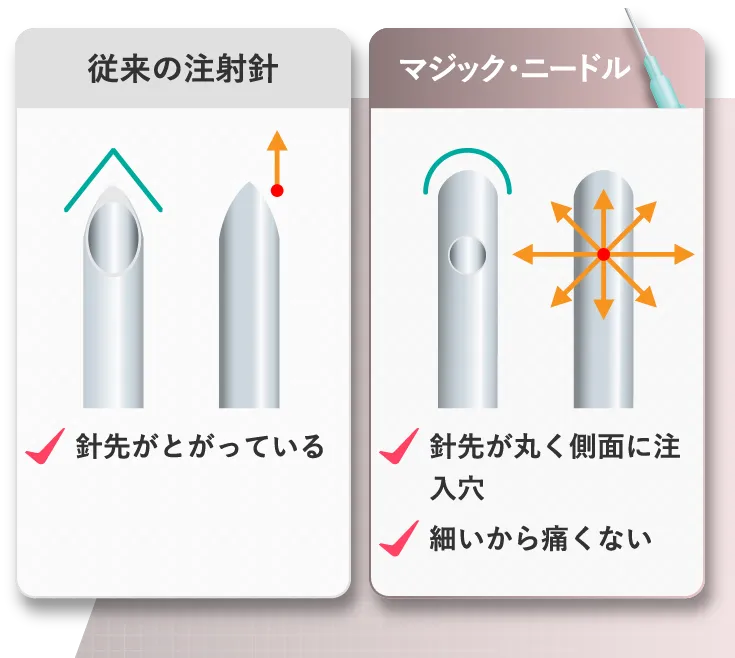 従来の注射針 マジック・ニードル