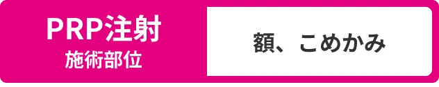 PRP注射施術部位：額、こめかみ