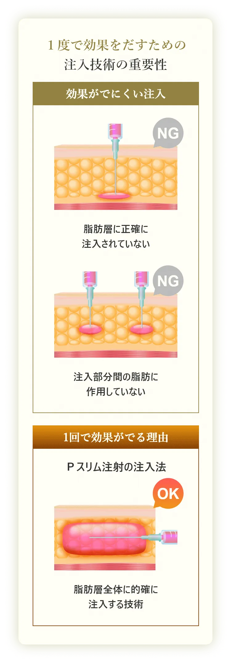 １度で効果をだすための注入技術の重要性