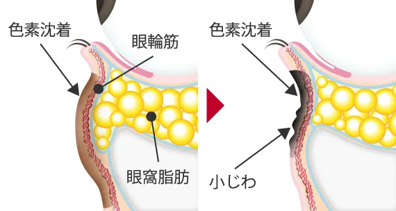 色素沈着や小ジワが治らない