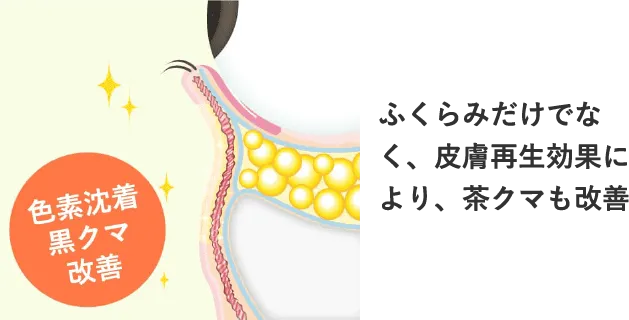 Step 3 ふくらみがなくなり、色素沈着や黒クマも皮膚再生効果により改善される