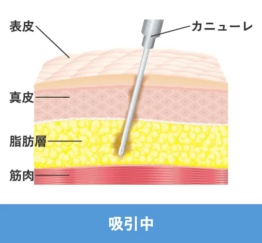 吸引中