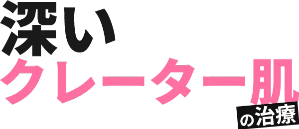 深いクレーター肌の治療