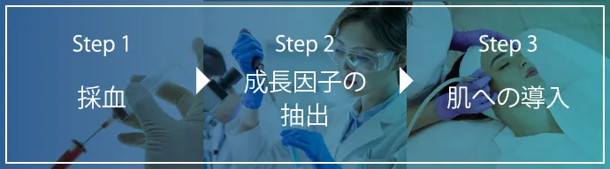 Step1 採血 Step2 成長因子の抽出 Step3 肌への導入