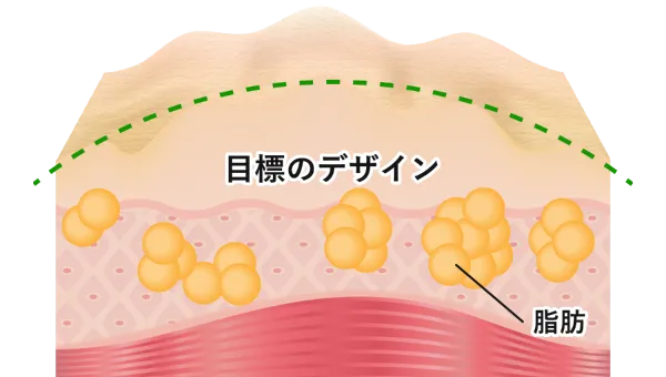 目標のデザイン　脂肪