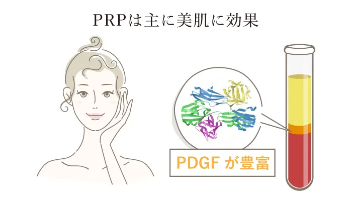 PRPは主に美肌に効果　PDGFが豊富